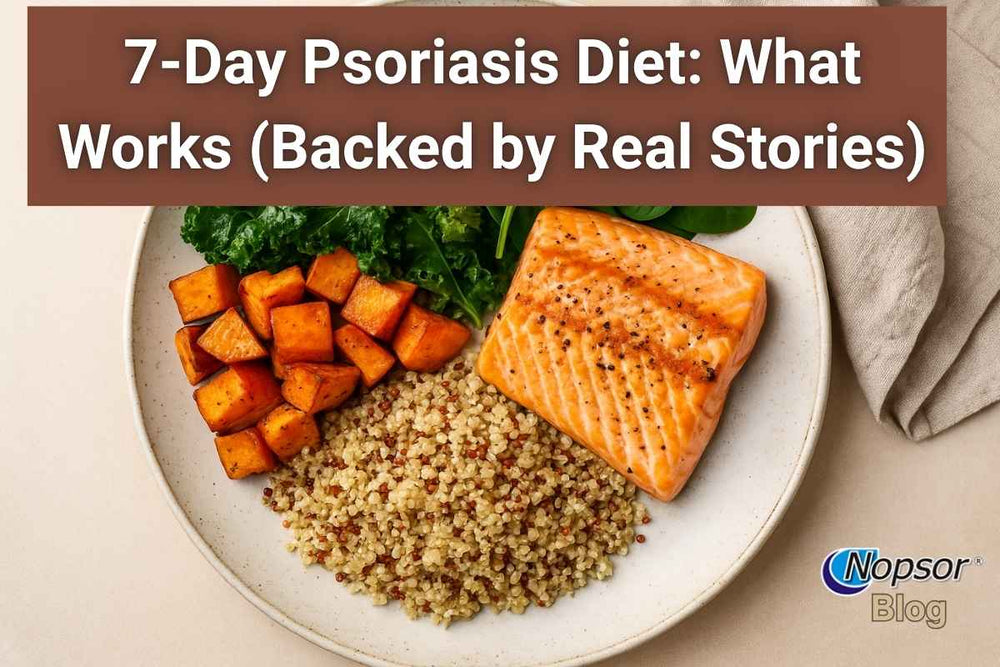 7-Day Psoriasis Diet: What Works (Backed by Real Stories)