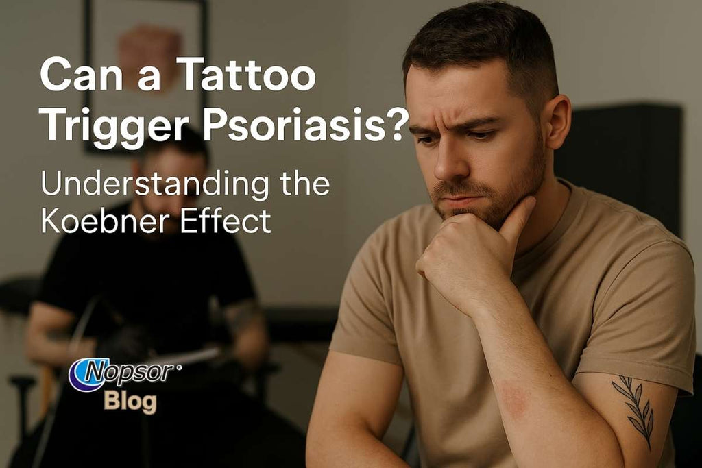 Can a Tattoo Trigger Psoriasis? Understanding the Koebner Effect