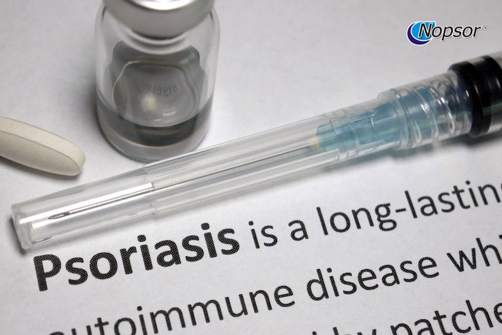 Frequently Asked Questions About Psoriasis Treatment Options