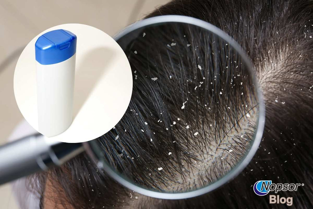 Prescription Shampoos for Dandruff: What to Know