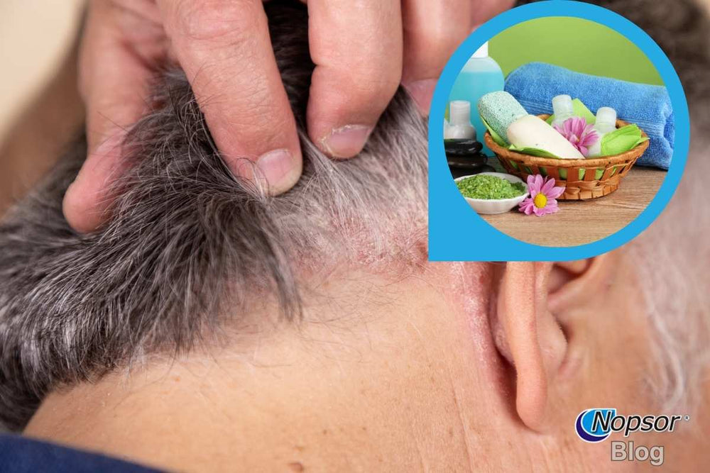 Psoriasis and Hair Care: How to Wash and Maintain Your Scalp