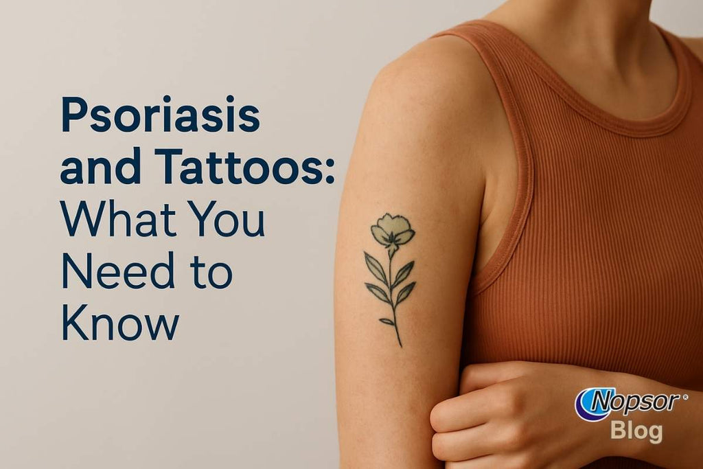 Psoriasis and Tattoos: Everything You Need to Know Before Getting Inked