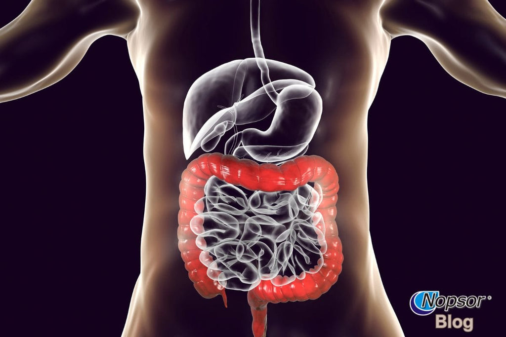 The Link Between Gut Health and Psoriasis