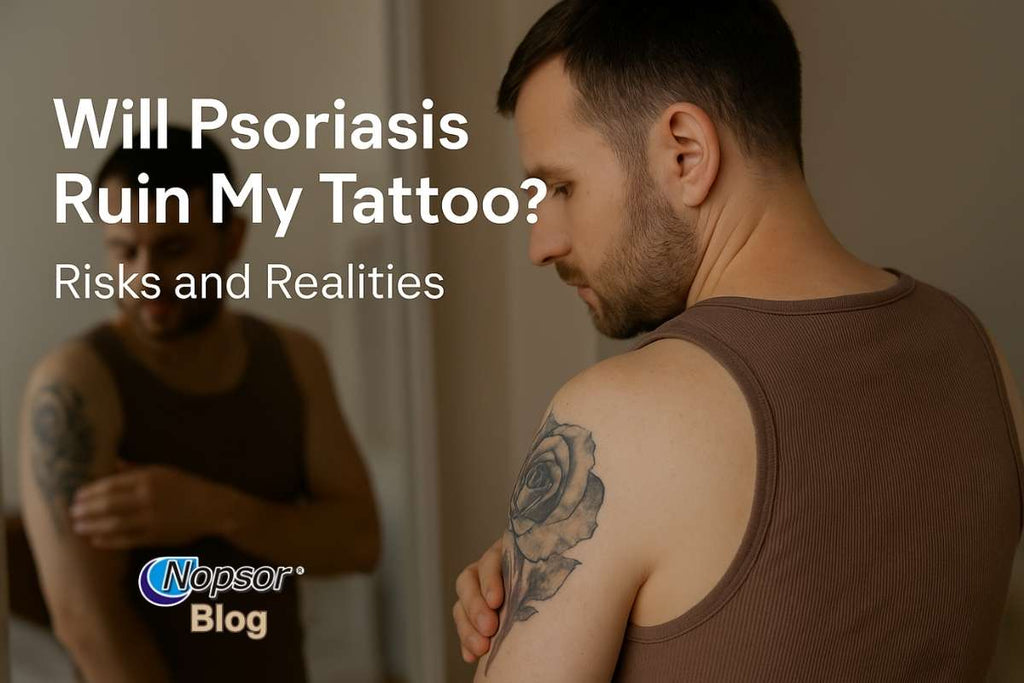 Will Psoriasis Ruin My Tattoo? Risks and Realities