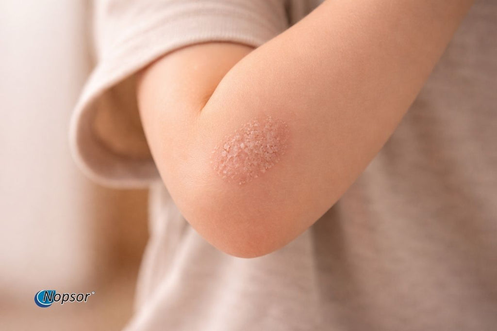 Close-up of a child's arm with a visible scar, wearing a light-colored shirt.