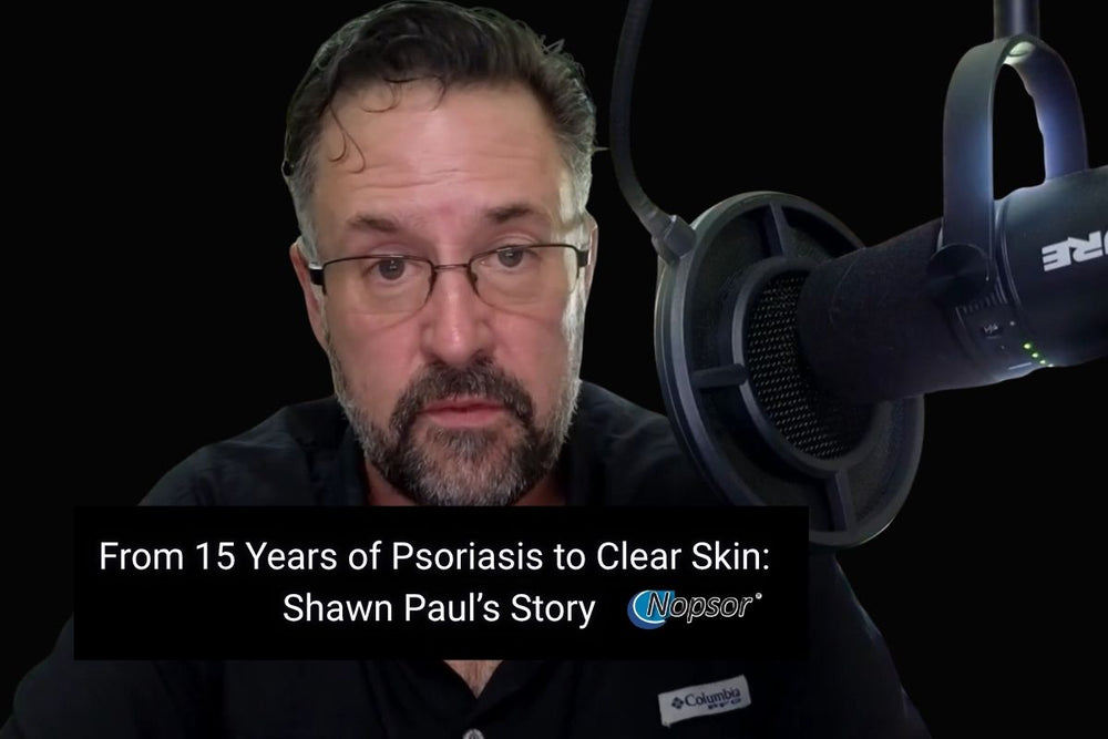 Shawn Paul's Story: 15 Years of Psoriasis, Gone in One Month