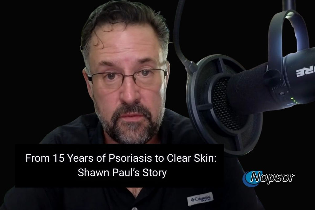 From 15 Years of Psoriasis to Clear Skin: Shawn Paul’s Story