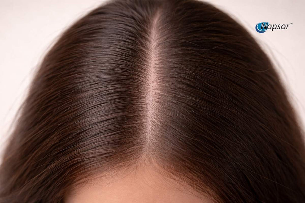 Close-up of a person's head with dark hair, showing the hairline.