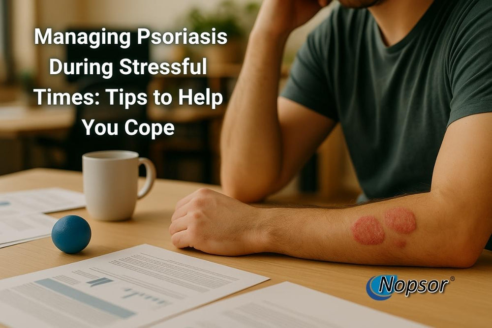 Managing Psoriasis During Stressful Times Tips to Help You Cope