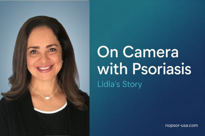 On Camera with Psoriasis: Lidia Barón's Story