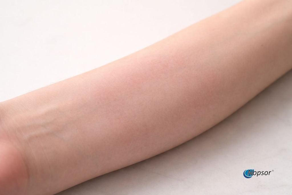 Close-up of a person's arm on a light background with 'Nopsor' branding.