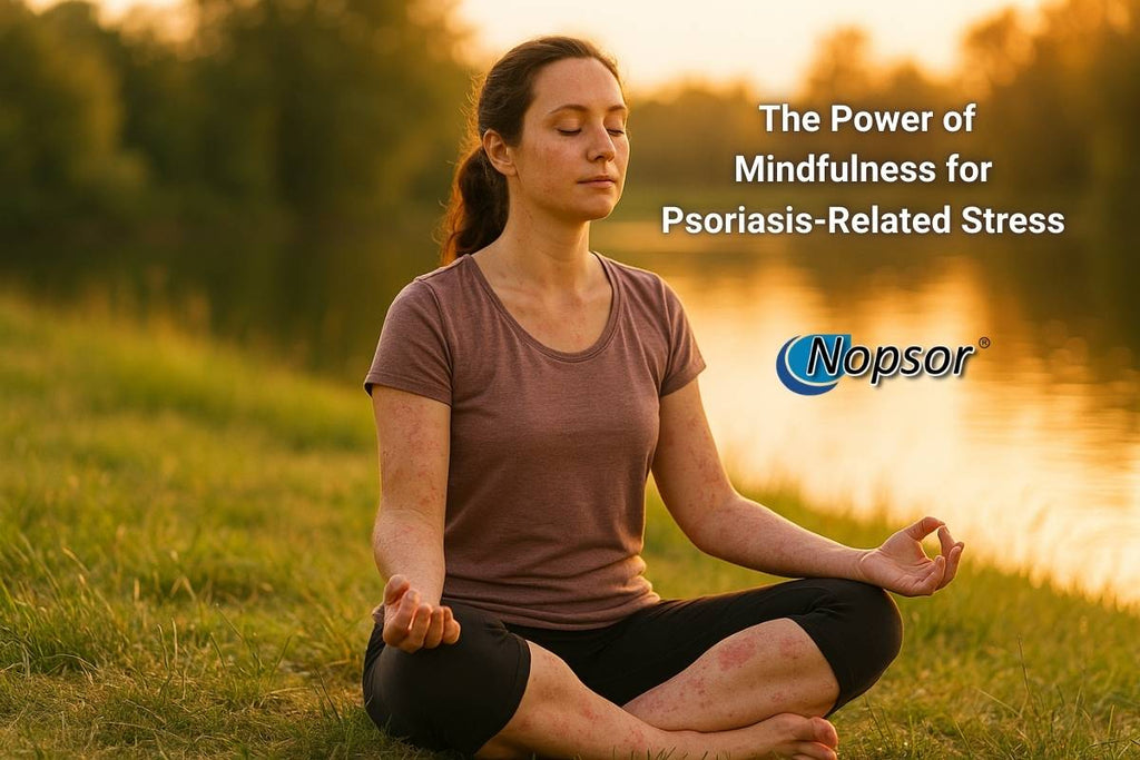 The Power of Mindfulness for Psoriasis-Related Stress