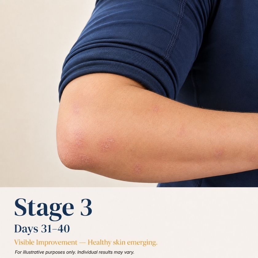 Person with a visible skin condition on their arm, labeled 'Stage 3' and 'Day 31-40'.