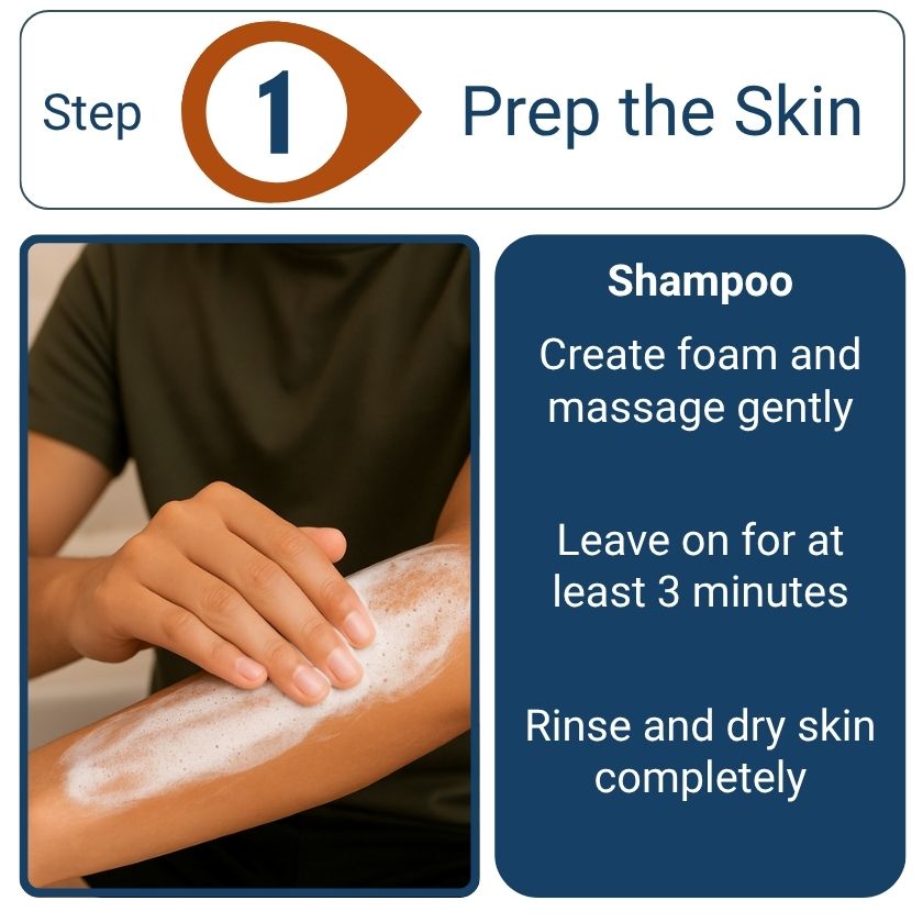 Champú Nopsor para la psoriasis: preparación diaria para el cuero cabelludo y la piel