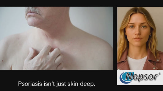 Video explaining Nopsor Psoriasis Treatement
